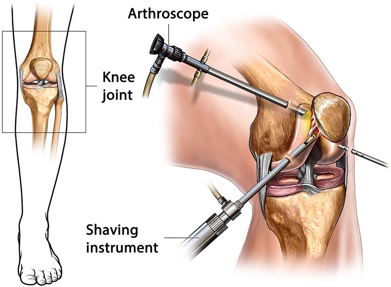 kinematic_alignment